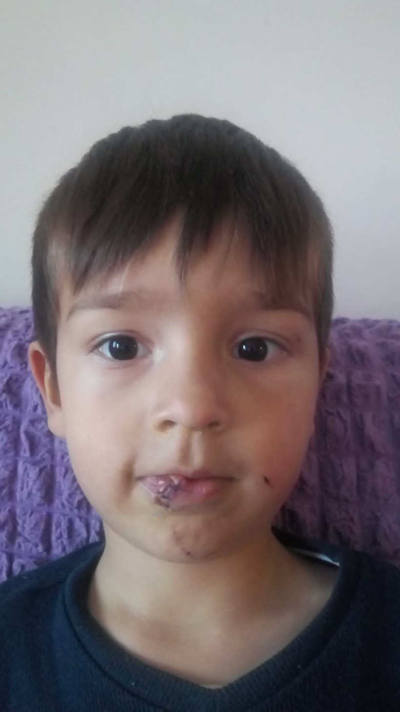 Bir köy köpek kabusu yaşıyor! Çocuklara saldırıyorlar 3 yaşındaki çocuk ölümden döndü - Resim: 2