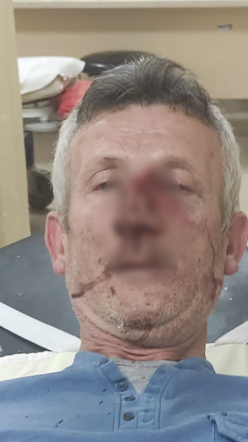 Sitedeki fahiş zam için eylem yaptı neye uğradığını şaşırdı! Kanlar içinde gözünü hastanede açtı - Resim: 1