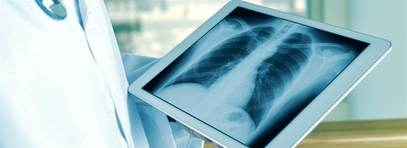 Kırılgan kemik yapısı kan kanseri habercisi olabilir! - Resim: 4