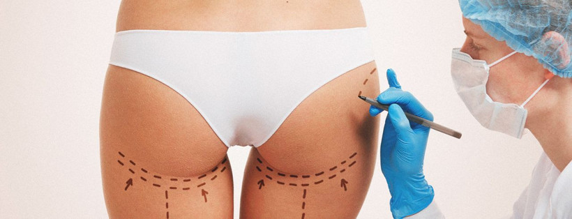 İstanbul'da estetik faciası! Kadının cinsel organı bacağına yapıştı - Resim: 3