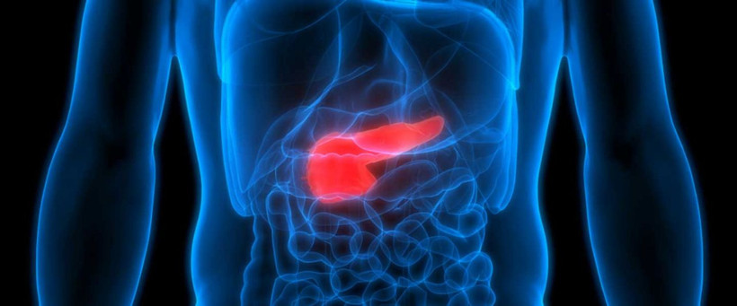 İnme nedir inmeden korunmak için neler yapmalıyız belirtileri neler? - Resim: 4