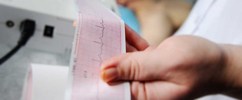 Taşikardi kalp çarpıntısı demek! Normal kalp hızı 100'ü geçerse... - Resim: 3