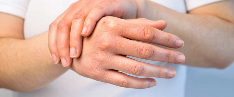 Hindistan cevizi yağının faydaları nelerdir cildinize sürerseniz... - Resim: 3