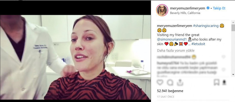 Meryem Uzerli kendini dünyaca ünlü estetik doktoruna teslim etti - Resim: 2