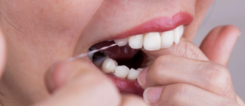 Bu 9 maddeye dikkat! Diş hekimleri asla yapmayın diyor... - Resim: 4