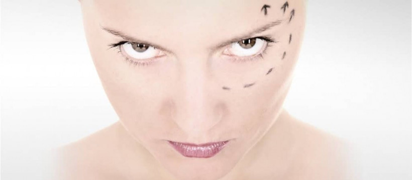 Kraliyet ailesi ve ünlülerin estetik sırları ifşa oldu! - Resim: 2