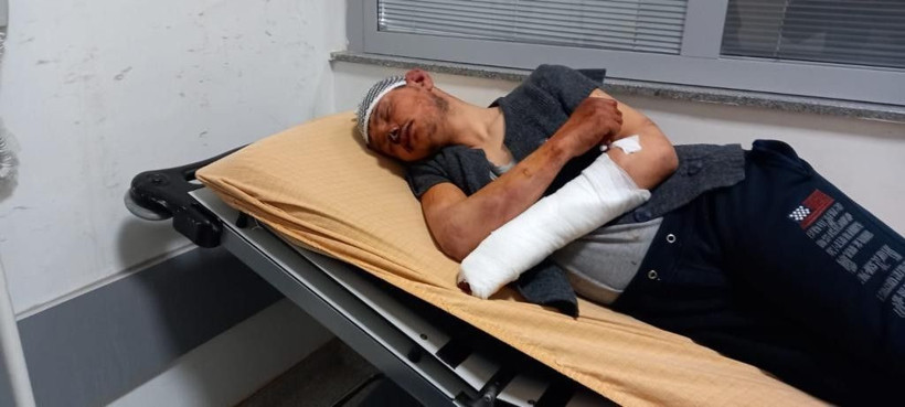 Afyonkarahisar'da 5 saat dövdüler Nazi işkenceleri aratmadı! Sebebi ise şok etti - Resim: 1