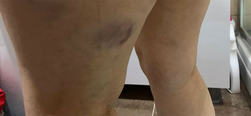 Eski eşinin kaçırıp dövdüğü kadının çığlığı! Beni kurtarın artık dayanamıyorum - Resim: 4