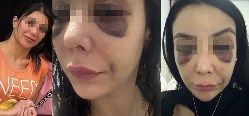 Konya'da eğlence mekanının tuvaletinde genç kadın dehşeti yaşadı - Resim: 1