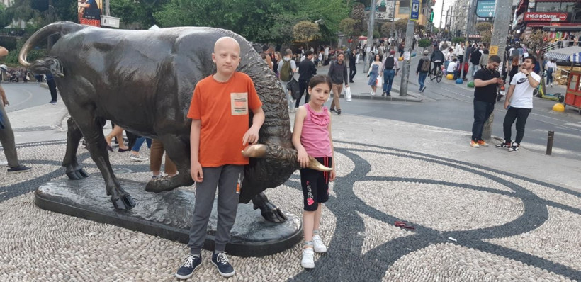 11 yıl önce gittiği berber hayatını kararttı! Kaşı da saçı da çıkmıyor.. - Resim: 3