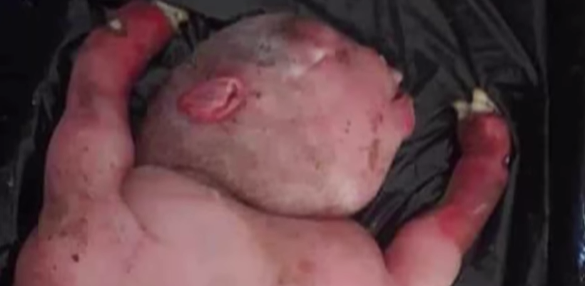 Köylüler yarı insan yarı hayvan bir şey buldu görenler şoke oldu - Resim: 2