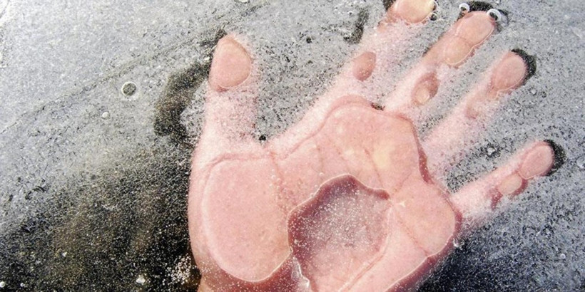 Dondurulan bedenler canlandırıldı  - Resim: 4