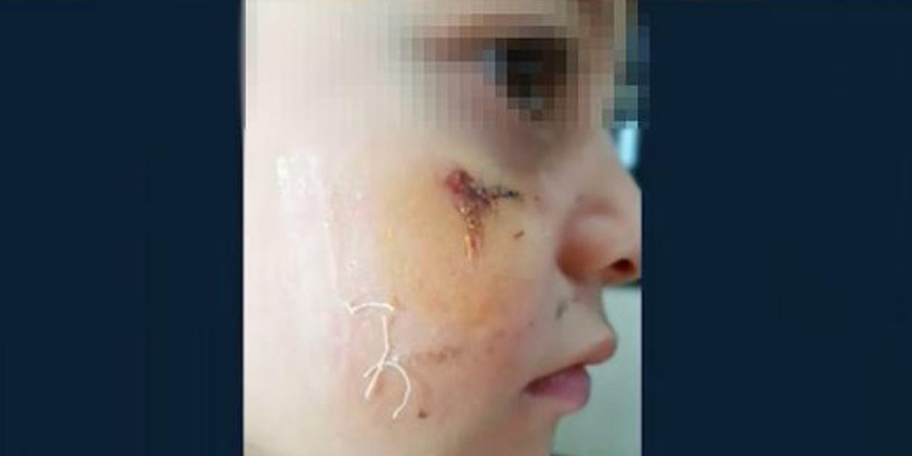 Ezgi Mola açtı ağzını yumdu gözünü o öğretmene çok sert tepki - Resim: 1