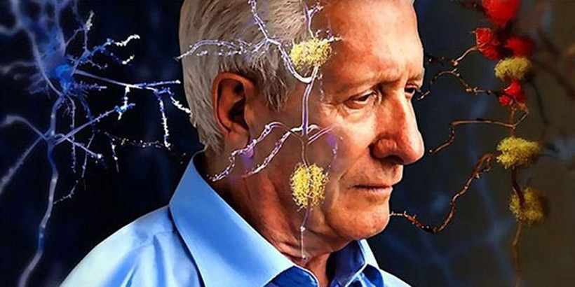 Tedavisi bulunmuyor! Bu değişiklikler Alzheimer belirtileri olabilir! - Resim: 4