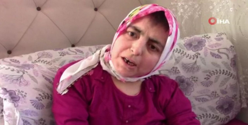 Dünyanın en fedakar annesi! Amasya'da çocuklarına gözü gibi bakıyor tek bir isteği var - Resim: 2