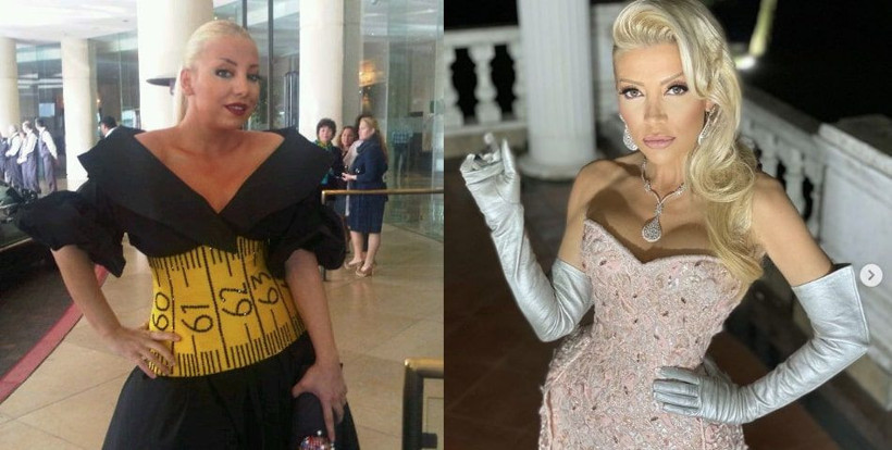 Gülşah Saraçoğlu'ndan olay yaratan estetik itirafı 'Yüz nakli yaptırdım diyebilirim' - Resim: 1