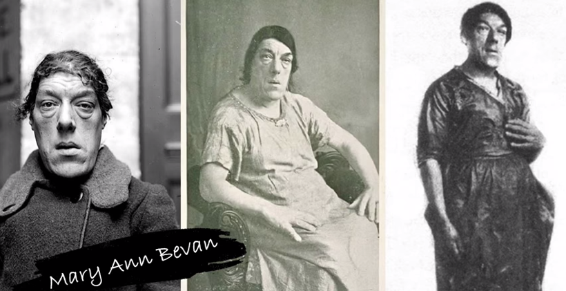 Bakan bir kez daha bakıyor genç kızın gözü ve burnu yok! - Resim: 2