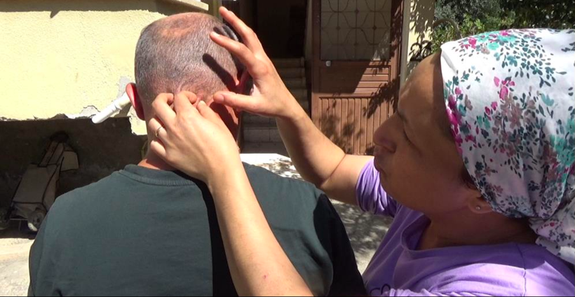 Ağızlarından, burunlarından kurtçuklar düşüyor, evlerine giremiyorlar! - Resim: 3