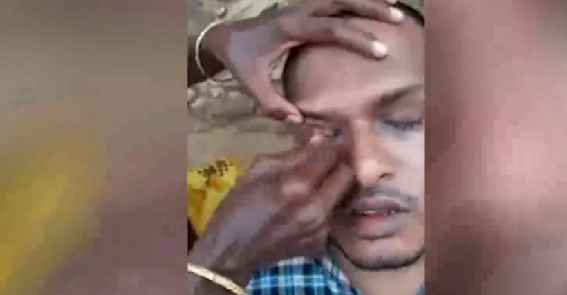 Sokak ortasında göz operasyonu - Resim: 1