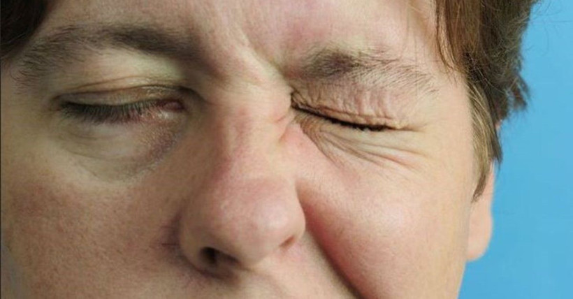 Göz seğirmesi neden olur göz seğirmesi nasıl tedavi edilir? - Resim: 3