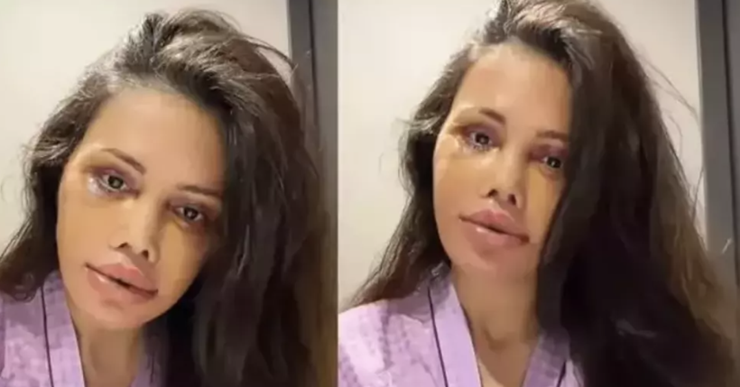 Didem Ceran sağlık durumunu açıkladı! Meğer o hastalıkla mücadele ediyormuş... - Resim: 4