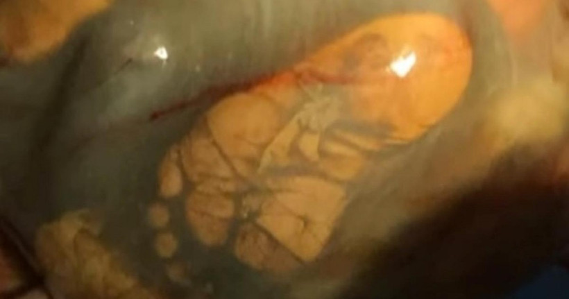 41 Haftalık hamileydi doktora gitmedi ama muayene edilince... - Resim: 1