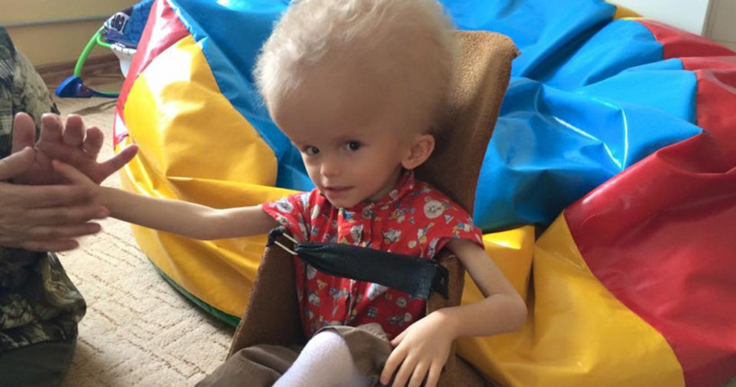 Hastalığı yüzünden ailesi doğar doğmaz terketti ama o pes etmedi - Resim: 1