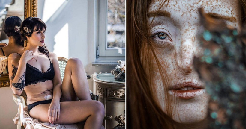 16 yaşındayken bağırsakları alındı 7 yıl sonra ise... - Resim: 1