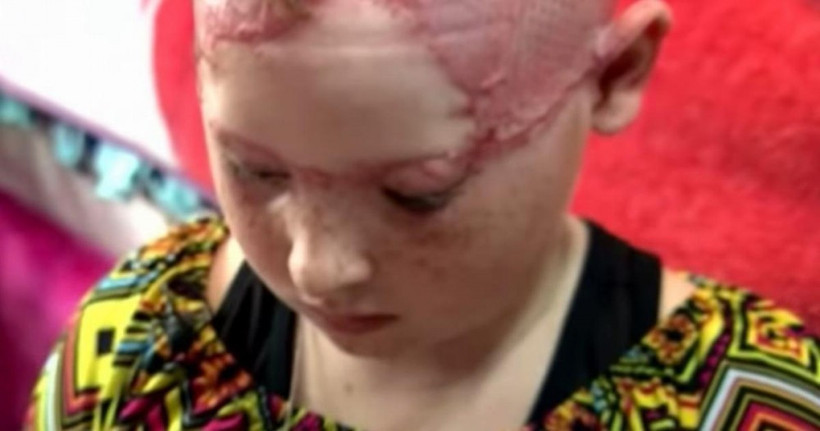 11 yaşındaki çocuk annesinin yanında bu hale geldi! - Resim: 2