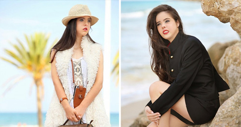 Doğduğunda odada büyük sessizlik oldu şimdi dünya onu konuşuyor - Resim: 1