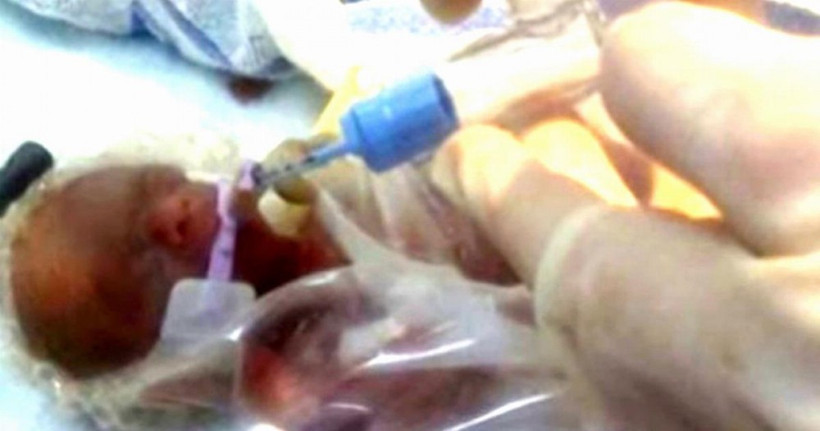 Bebeği yalnız ölmesin diye oyuncak tavşan bile aldı ama sonrası mucize! - Resim: 1