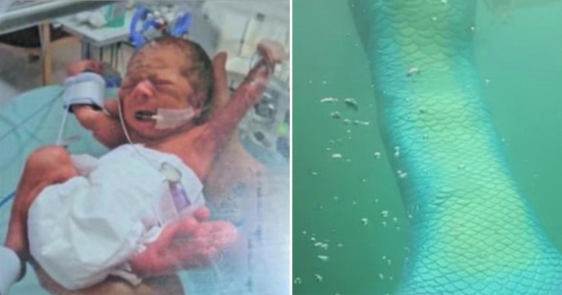 Doğuştan hastalığı vardı hemşire hayalini duydu ve... - Resim: 1