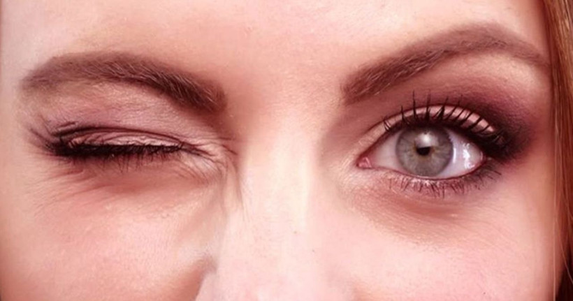 Göz seğirmesinin nedeni nedir ciddi bir durumun belirtisi mi? - Resim: 1