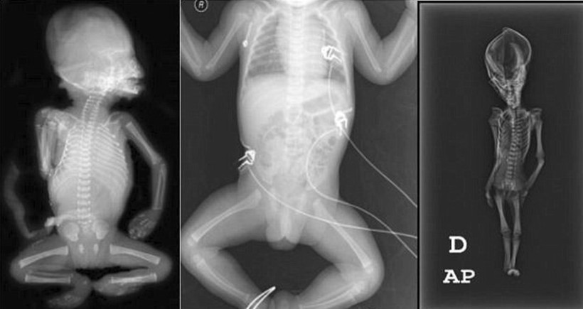Gizemli minik mumyanın sırrı çözüldü - Resim: 3