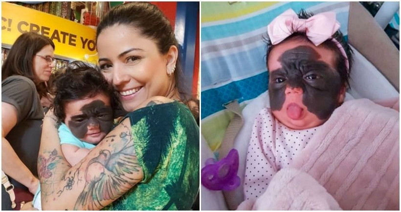 'Batman' maskesi ile doğdu iyileşmesi için on binlerce kişi seferber oldu - Resim: 2