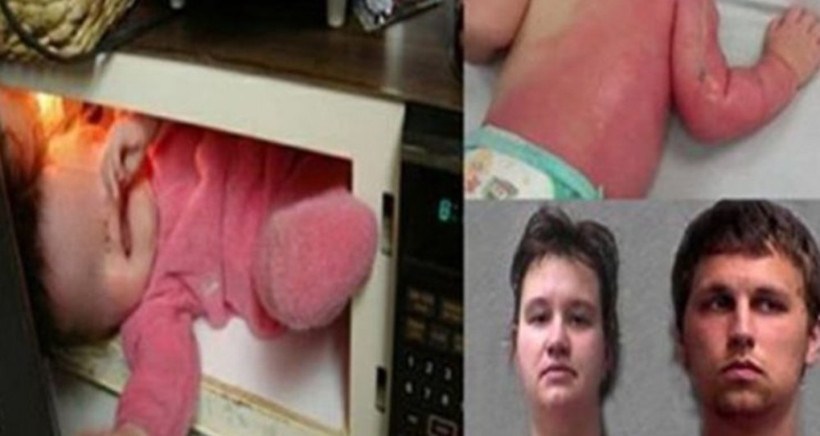 Bu nasıl vicdansızlık 4 aylık bebeklerini mikrodalgada yaktılar! - Resim: 2