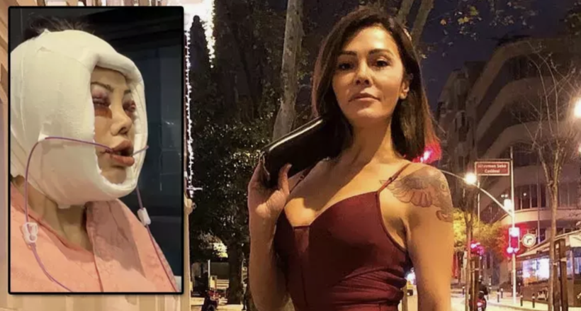 Didem Ceran sağlık durumunu açıkladı! Meğer o hastalıkla mücadele ediyormuş... - Resim: 2