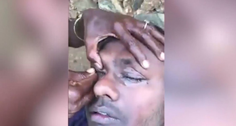 Sokak ortasında göz operasyonu - Resim: 3