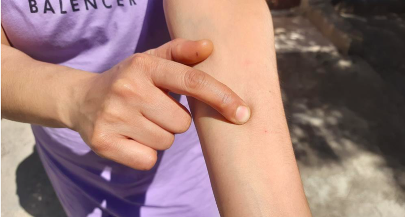 Ağızlarından, burunlarından kurtçuklar düşüyor, evlerine giremiyorlar! - Resim: 2