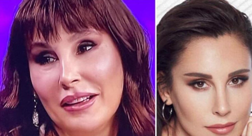 Funda Arar estetiklerden sonra bambaşka biri oldu! İşte yaptırdığı operasyonlar - Resim: 3