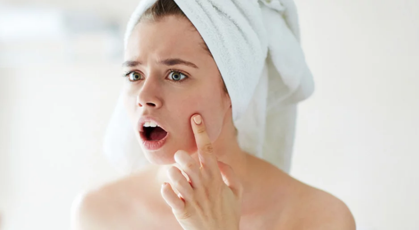 Sivilceden kurtulamıyorsanız bunları sakın yemeyin! - Resim: 3