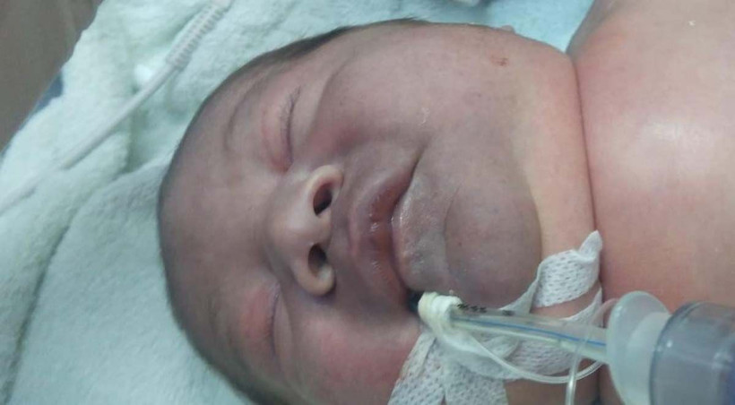 Bebeğin doğumda köprücük kemiği kırıldı doktor bıraktı gitti iddiası! - Resim: 3