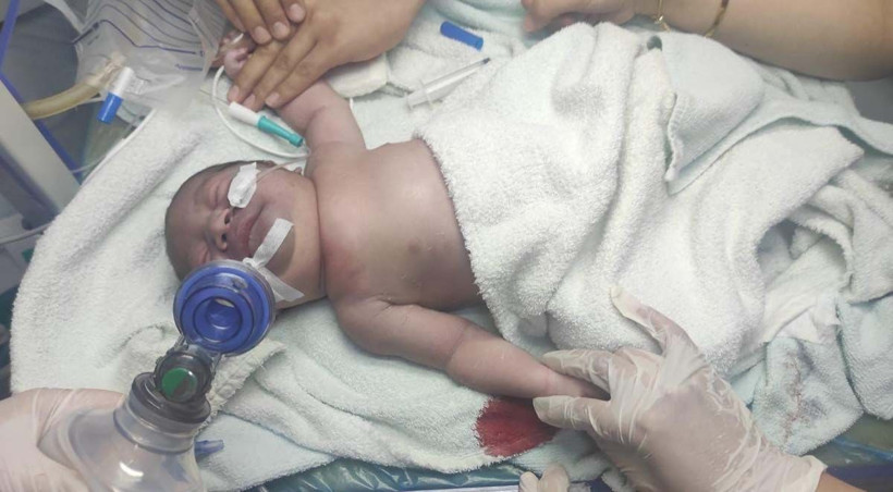 Bebeğin doğumda köprücük kemiği kırıldı doktor bıraktı gitti iddiası! - Resim: 1