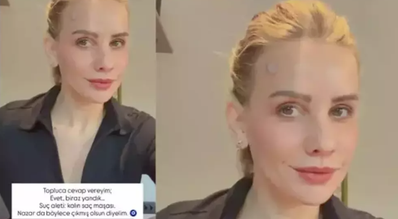 Ünlü sunucu Esra Erol yayın öncesi korkuttu! Saç maşası yüzüne deyince... - Resim: 3