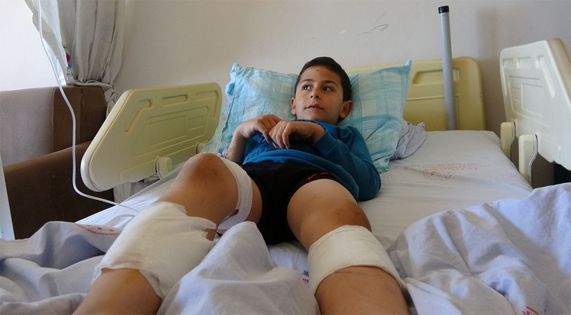 Evinin önünde 7 yaşındaki çocuğa 4 köpek birden saldırdı - Resim: 2