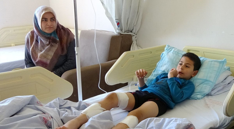 Evinin önünde 7 yaşındaki çocuğa 4 köpek birden saldırdı - Resim: 1