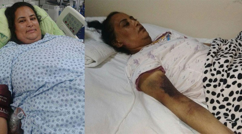 Midesini küçülten kadın hayatını kaybetti - Resim: 3