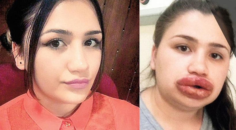 Hemşireyi bu hale getirmişti, yakalandı, ilk sözü bu oldu - Resim: 2