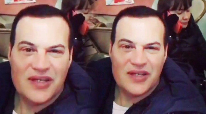 Hakan Peker estetikle bambaşka birine dönüştü açıklaması şaşkına çevirdi - Resim: 2