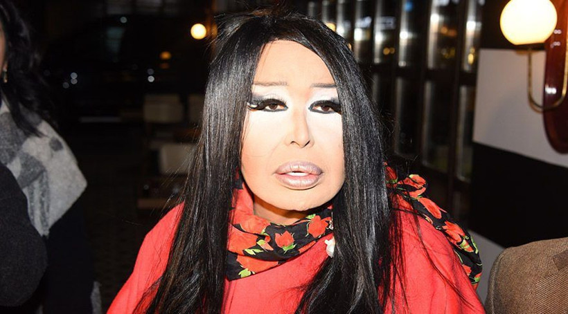 Bület Ersoy'un Hepatit B olduğunu iddia etmişti! 2 Yıla kadar hapsi isteniyor - Resim: 2